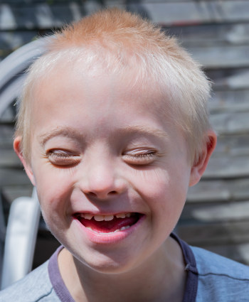 Visually impaired child laughing